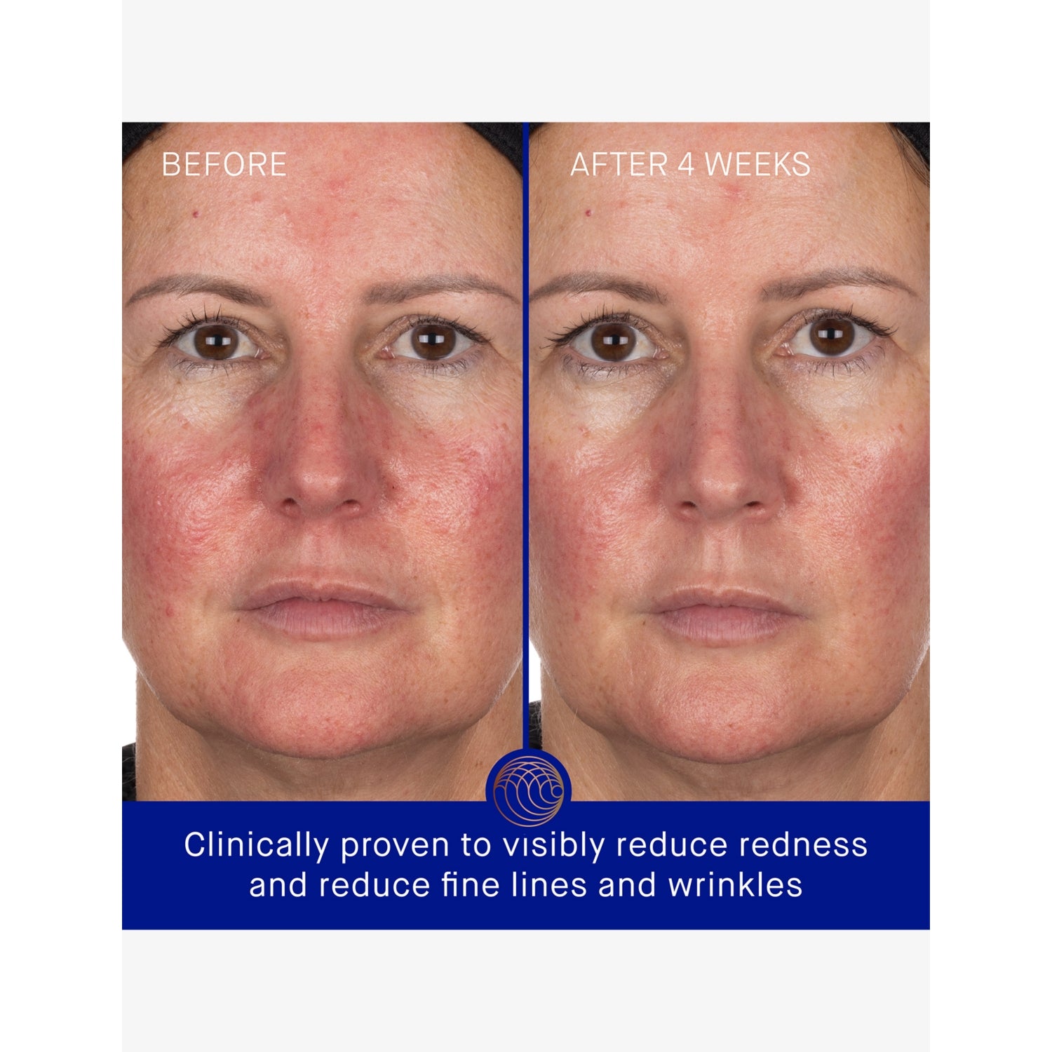 Augustinus Bader hydrogel face mask 30g, imported from the UK