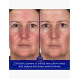 Augustinus Bader hydrogel face mask 30g, imported from the UK