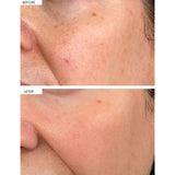 111SKIN dark spot correcting serum 30ml, imported from the UK
