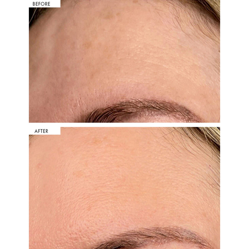 111SKIN dark spot correcting serum 30ml, imported from the UK