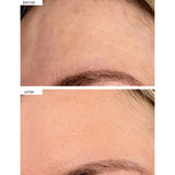 111SKIN dark spot correcting serum 30ml, imported from the UK