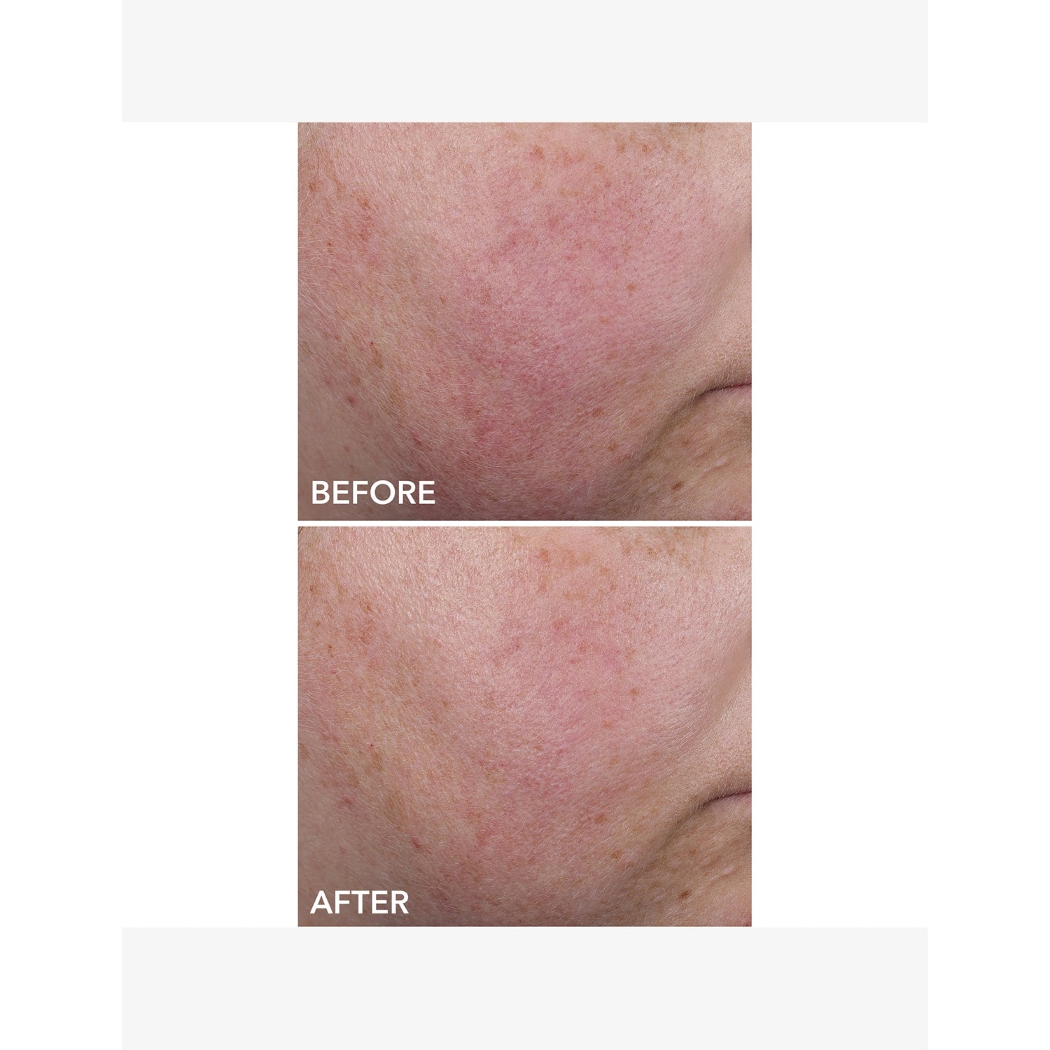Dr Dennis Gross Blur Repair Cream 20ml, imported from the UK