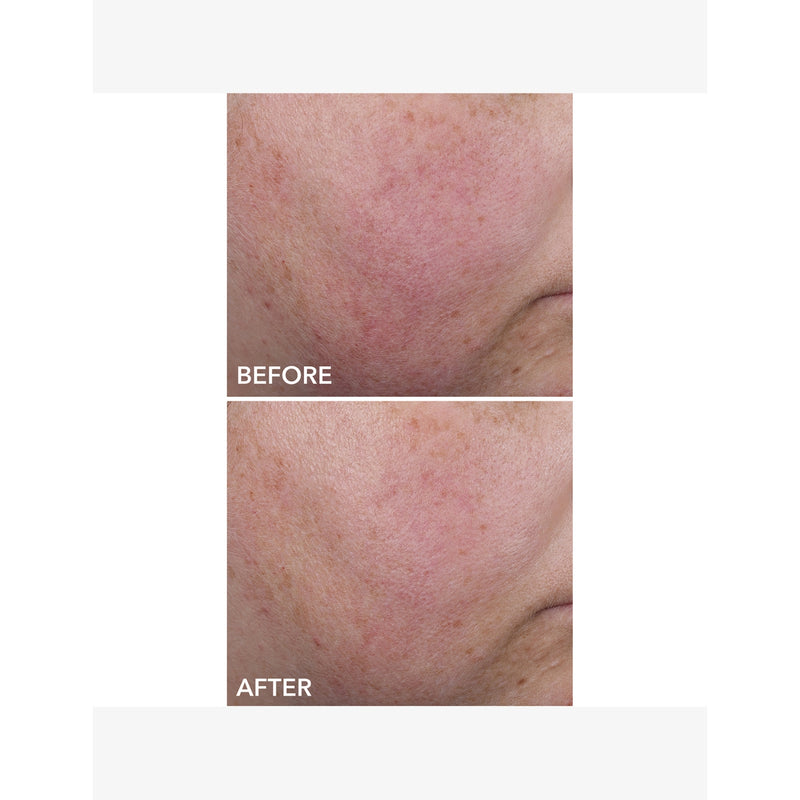 Dr Dennis Gross Blur Repair Cream 20ml, imported from the UK