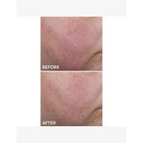 Dr Dennis Gross Blur Repair Cream 20ml, imported from the UK