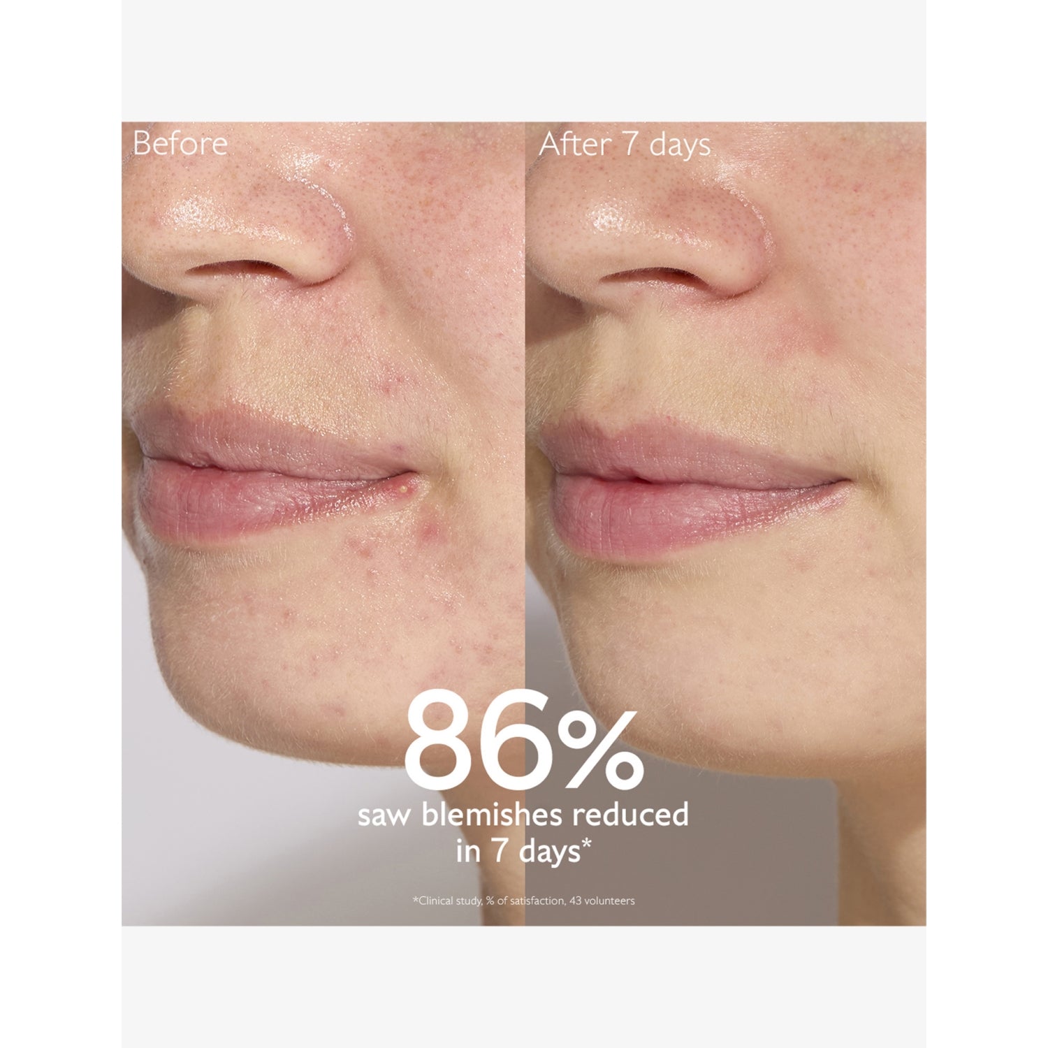 Caudalie Vinopure salicylic acid serum 30ml for blemish control (British brand)