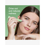 Caudalie Vinopure spot solution 15ml - British product