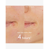 Caudalie Vinopure spot solution 15ml - British product