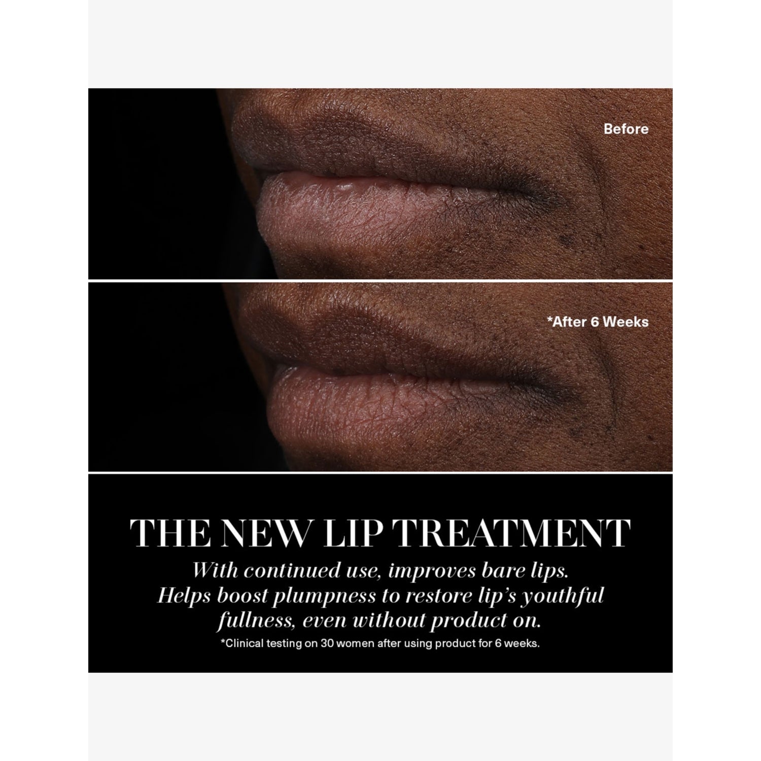 La Mer The Lip Treatment 3.4g with Miracle Broth - British product