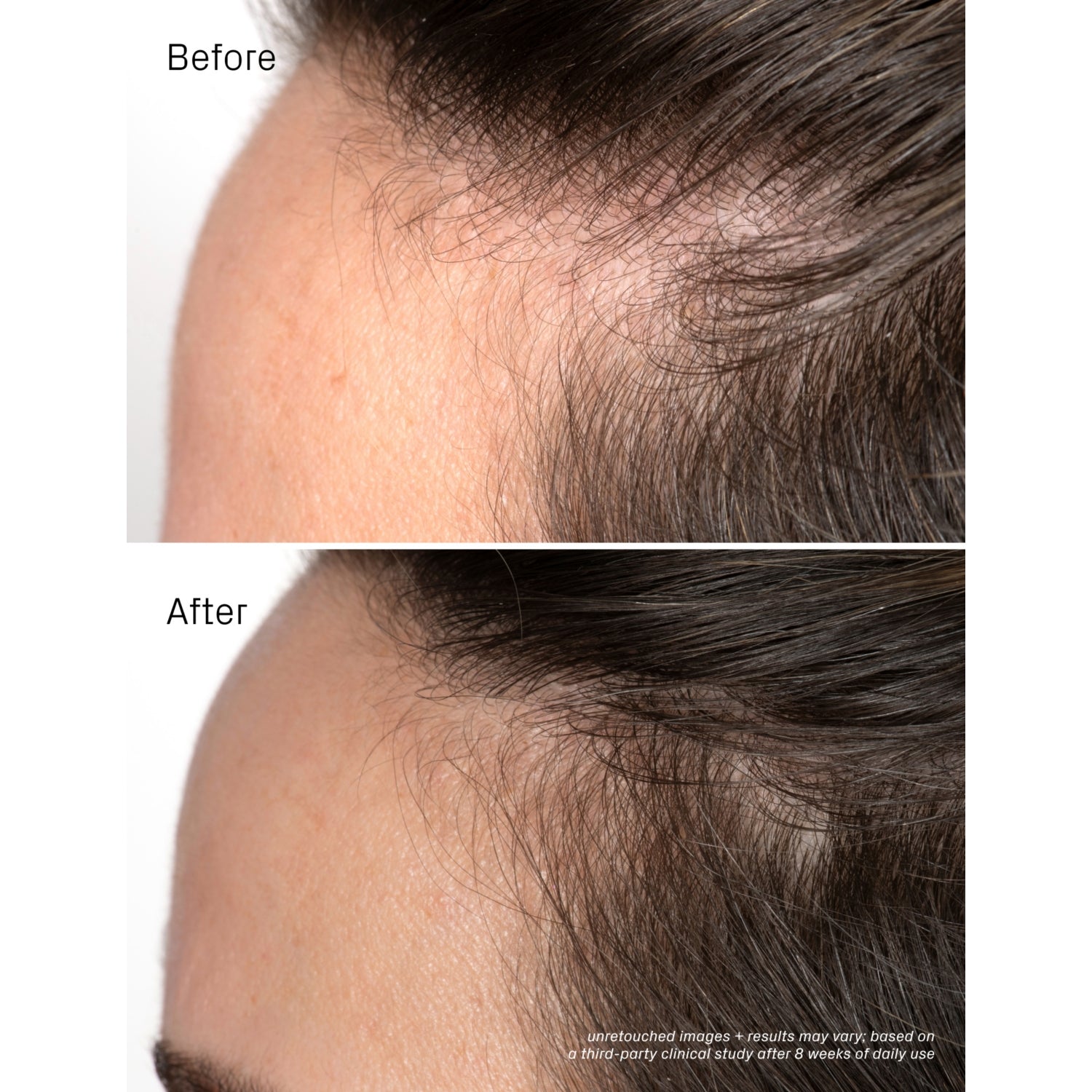 Isima Iconic Densifying Scalp Serum 50ml, imported from the UK