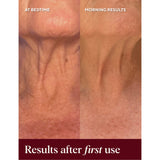 NAYDAYA neck wrinkle shield silicone patch - British product