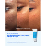 Murad blemish control clarifying cleanser 148ml - British product