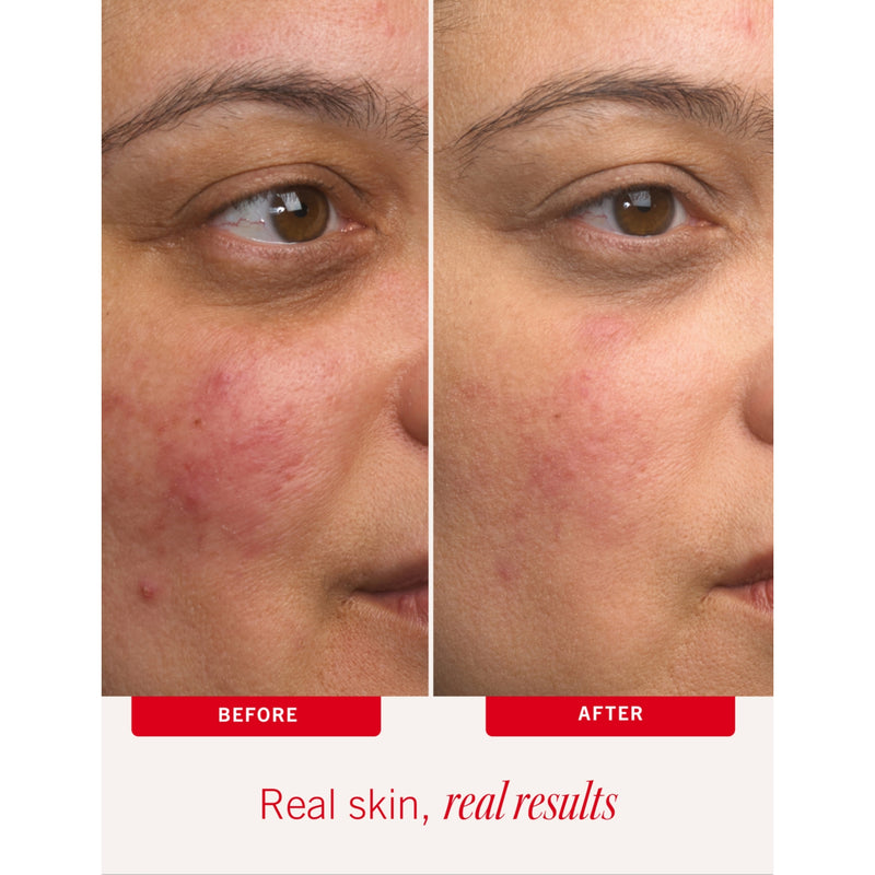 First Aid Beauty Ultra Repair Cream 56.7g, UK version