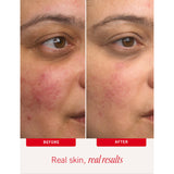 First Aid Beauty Ultra Repair Cream 56.7g, UK version