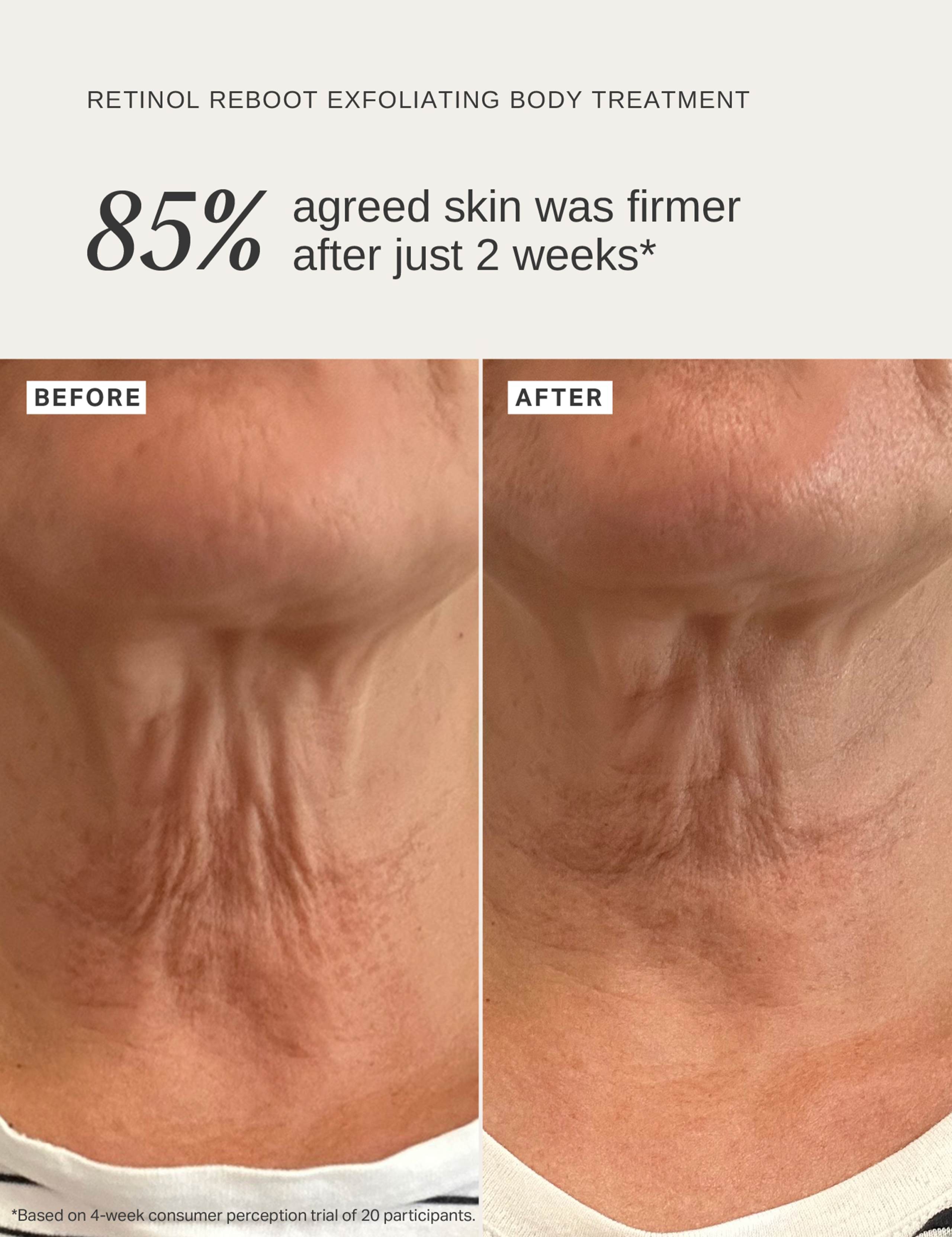 Retinol Reboot Exfoliating Body Treatment 120ml, imported from the UK