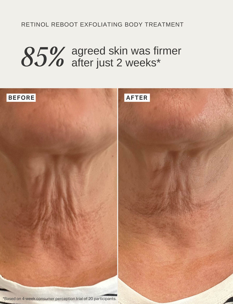 Retinol Reboot Exfoliating Body Treatment 120ml, imported from the UK