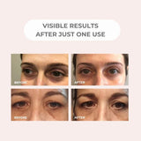 BEAUTICAL Microneedle Eye Patches 1pair