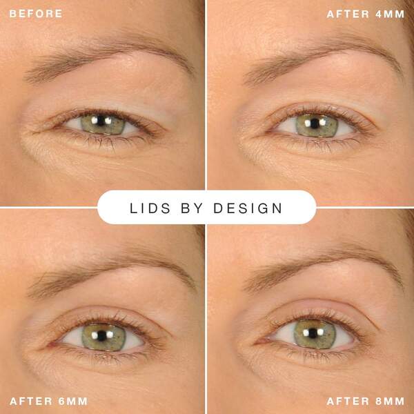Contours Rx Lids by Design Eyelid Lift Strips. (4mm - 7mm)