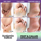 BB® Luxury Foot Mask Socks - Exfoliate, Peel & Soften- Lavender & Mint