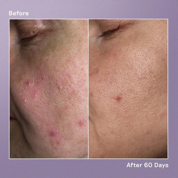 Balance Me Azelaic Dark Spot Serum 30 ml
