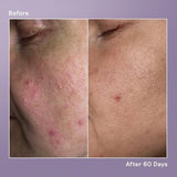 Balance Me Azelaic Dark Spot Serum 30 ml