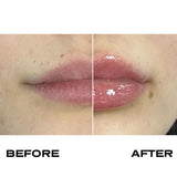 Plump It! No Needles Lip Filler Kit: Lip Builders