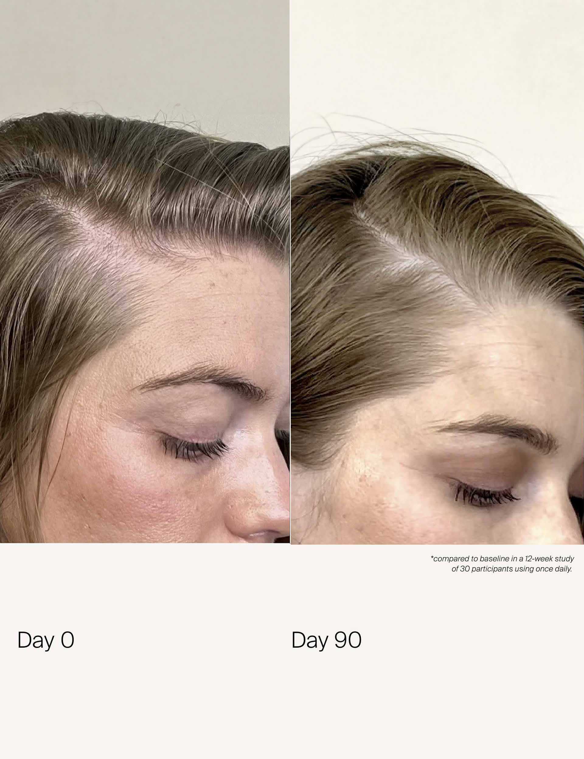 Living Proof scalp care density serum 50ml (British brand)