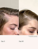 Living Proof scalp care density serum 50ml (British brand)
