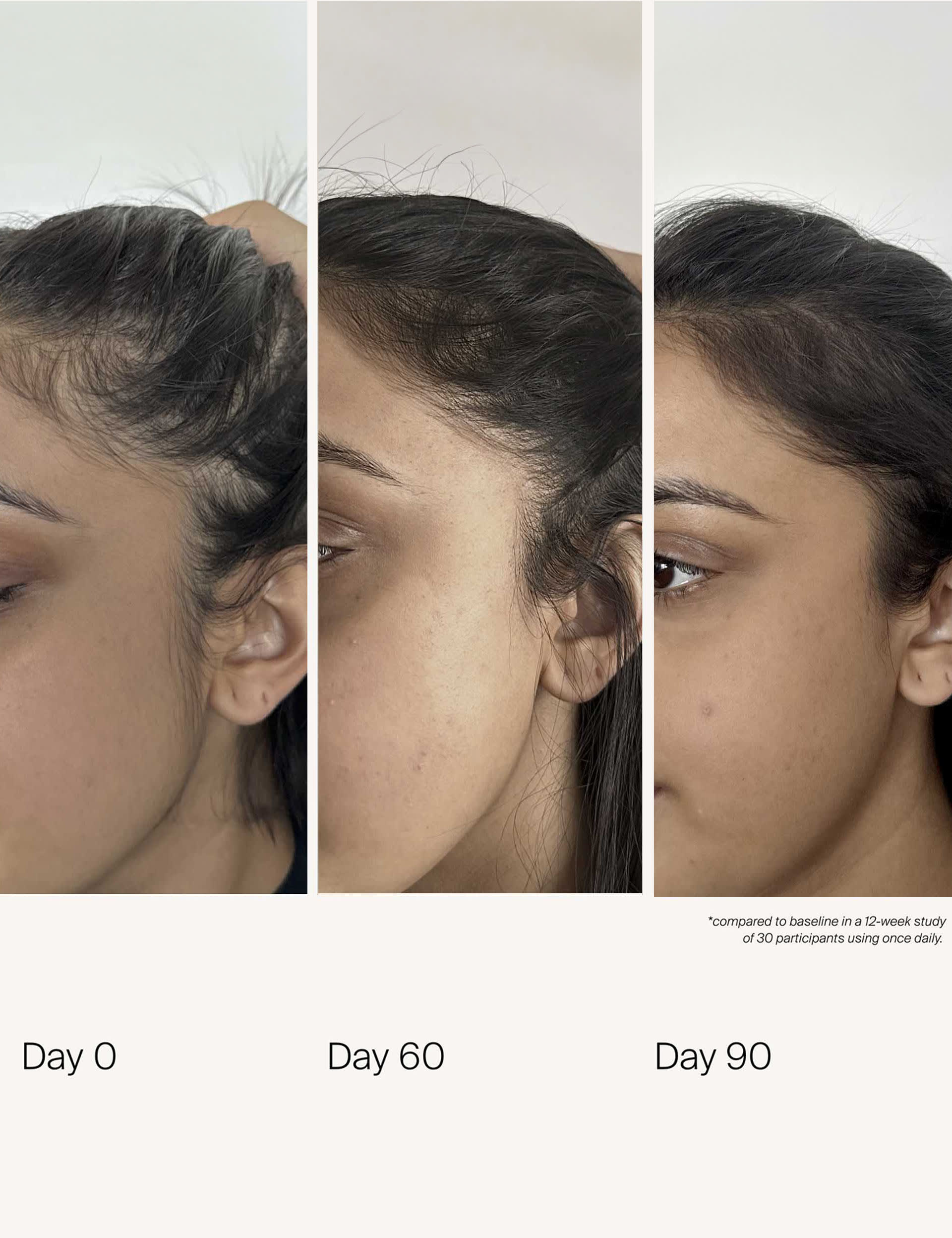 Living Proof scalp care density serum 50ml (British brand)
