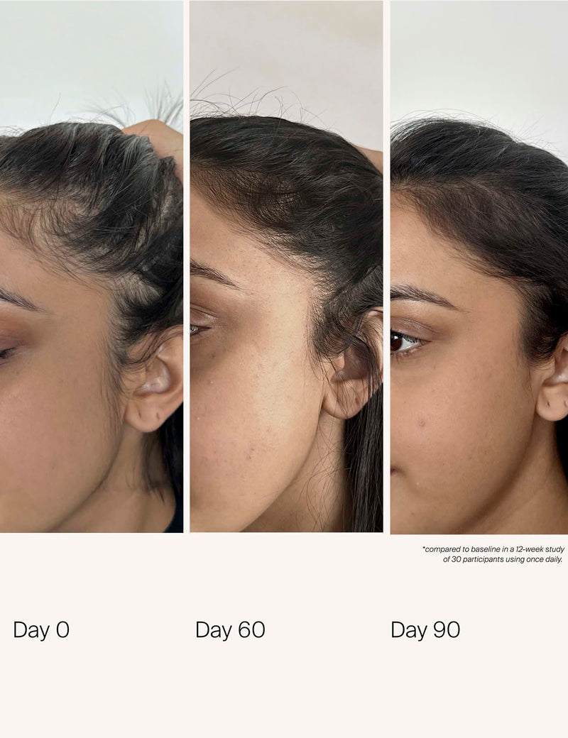 Living Proof scalp care density serum 50ml (British brand)