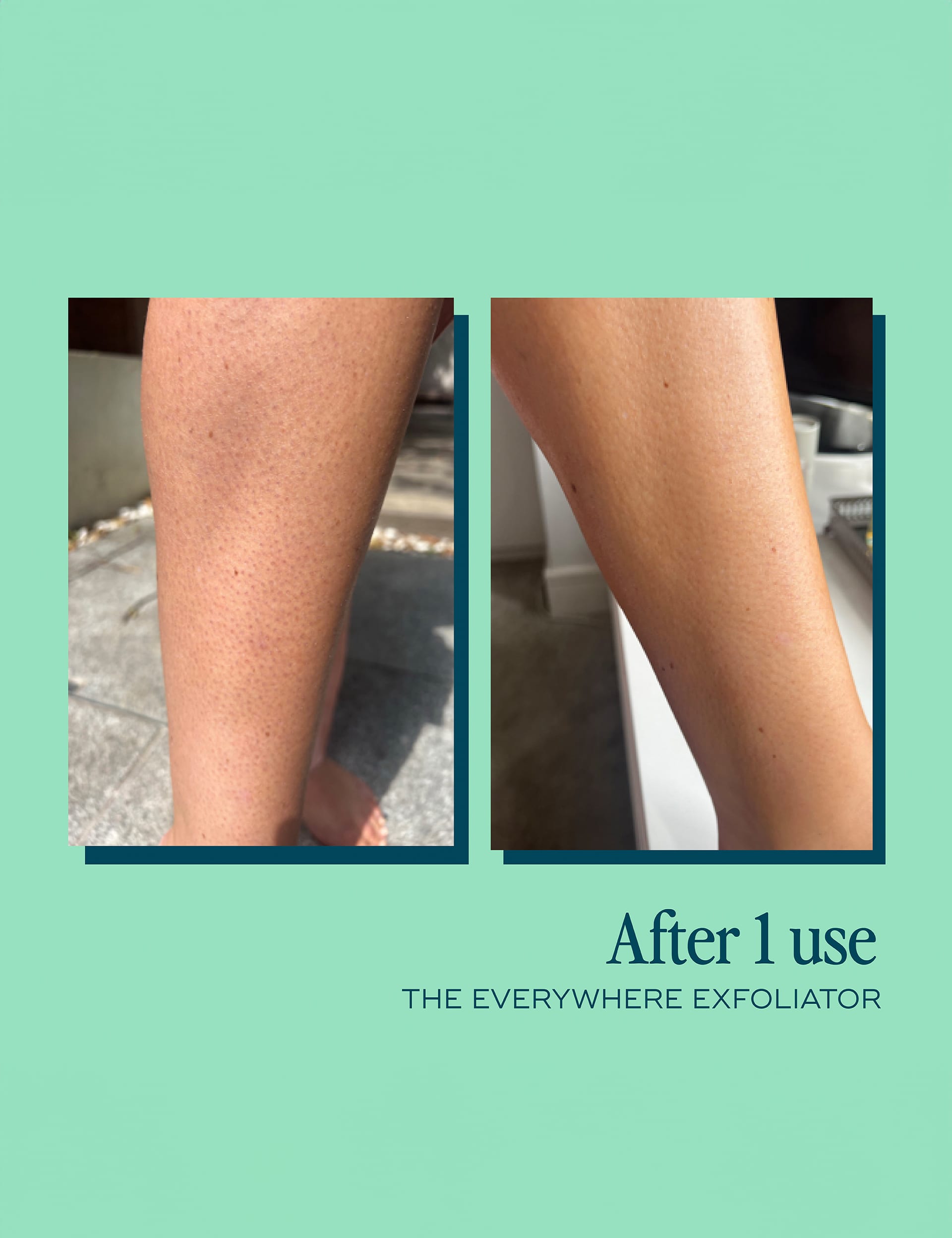 Everywhere Exfoliator for KP body scrub 180ml (British brand)