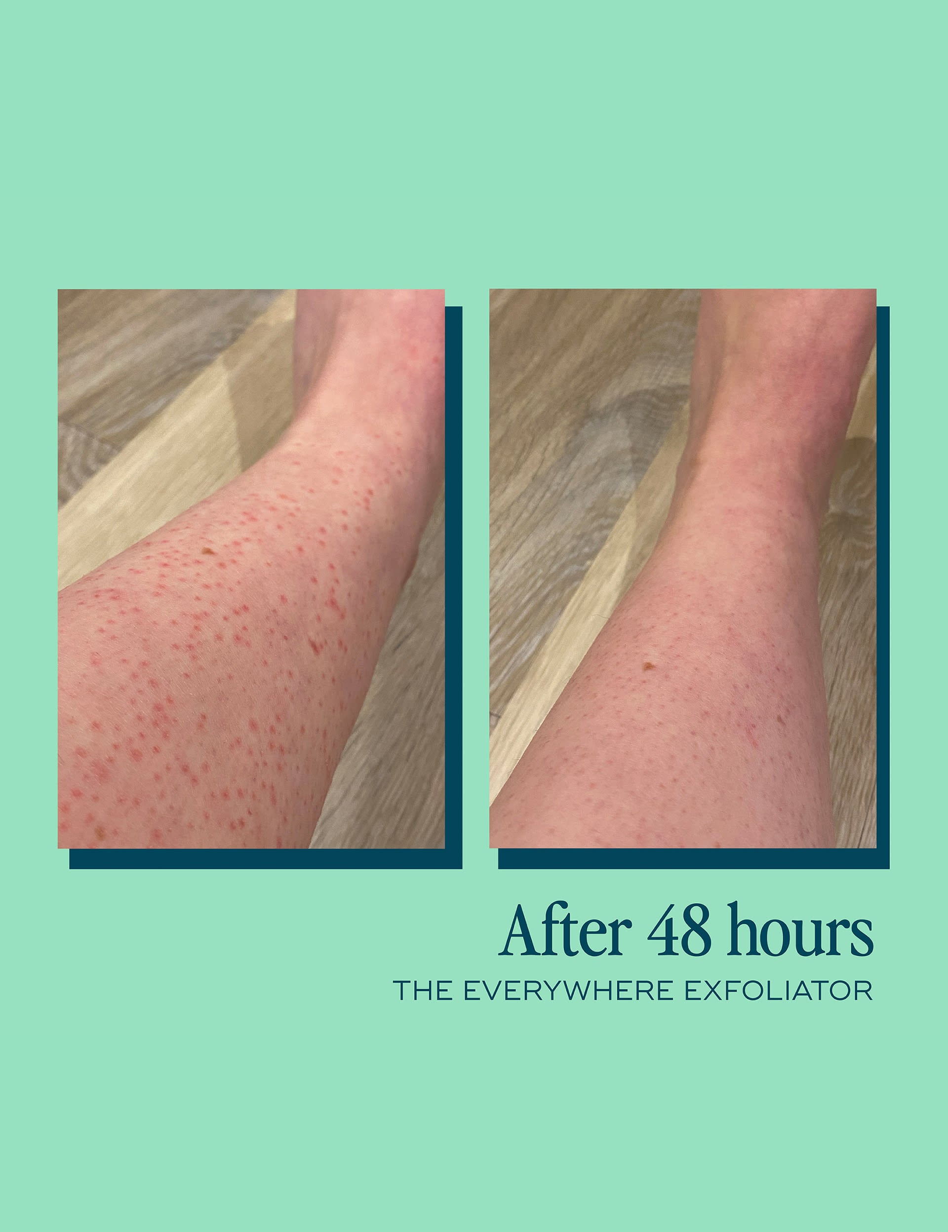 Everywhere Exfoliator for KP body scrub 180ml (British brand)