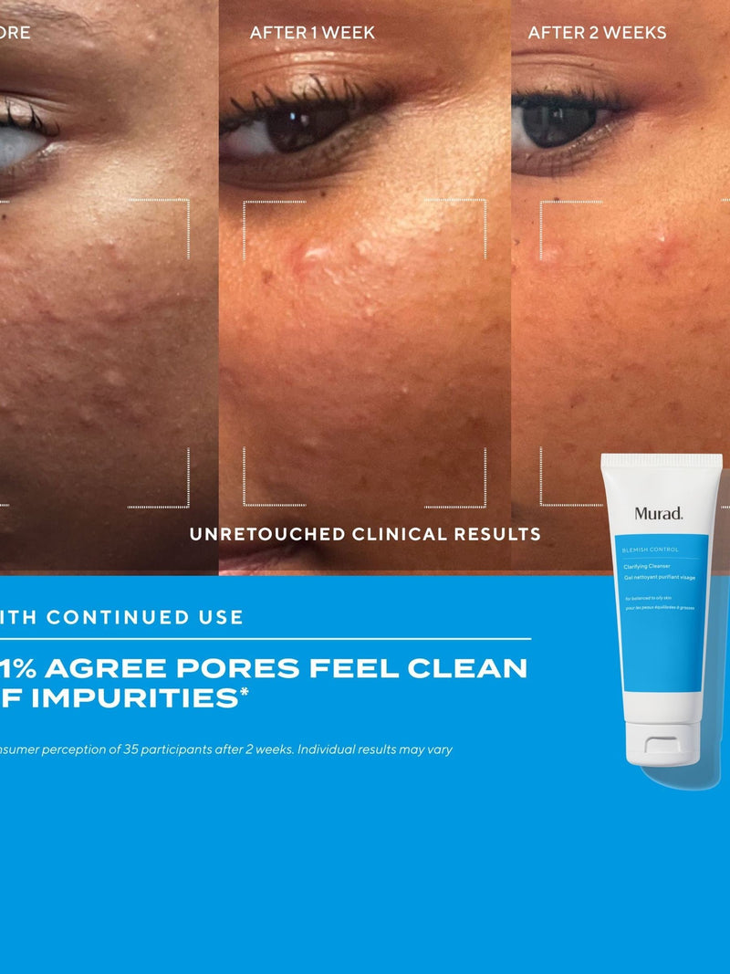 Murad clarifying cleanser 148ml, imported from the UK