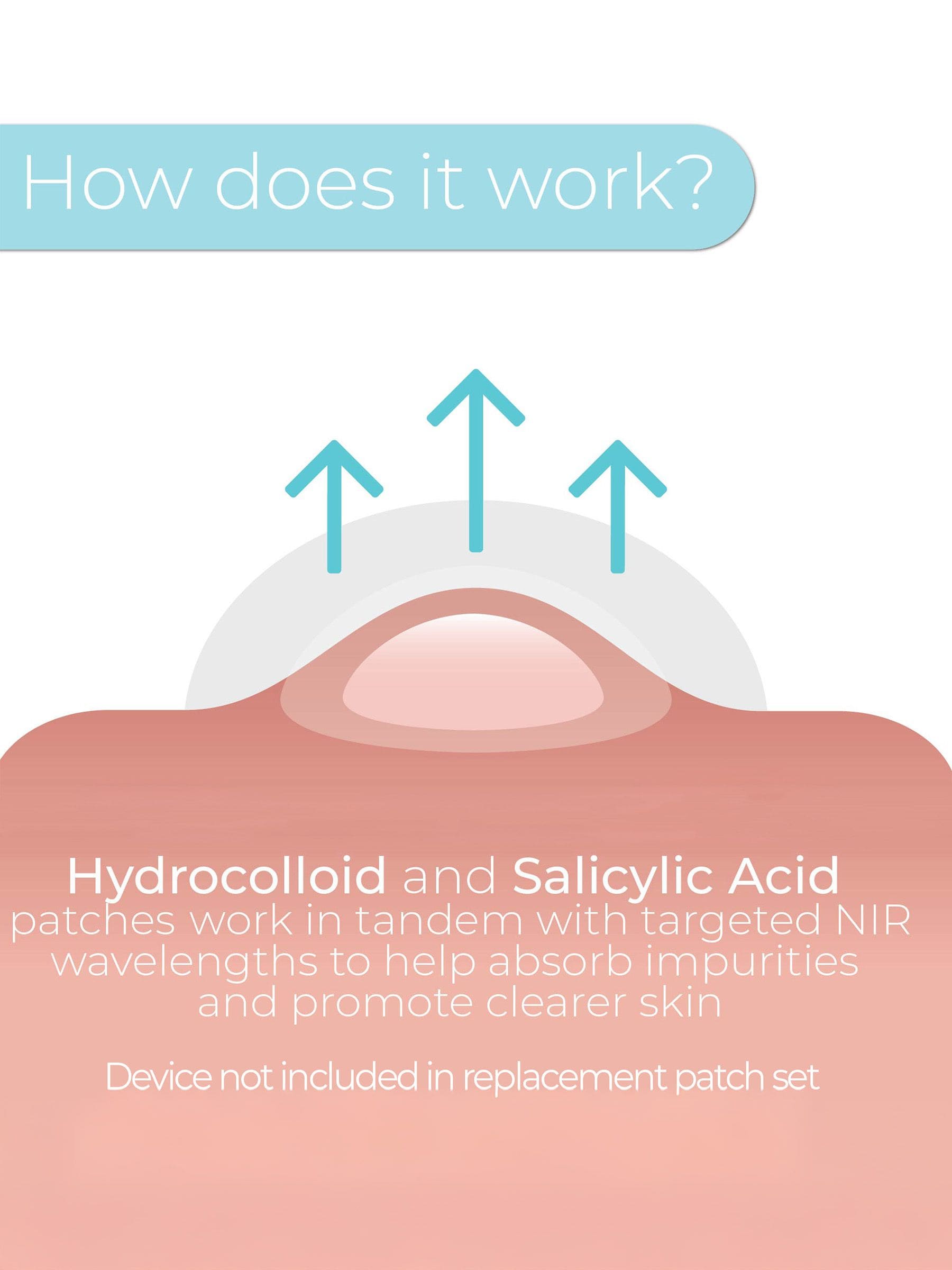 STYLPRO hydrocolloid salicylic acid patches 20 count - British product