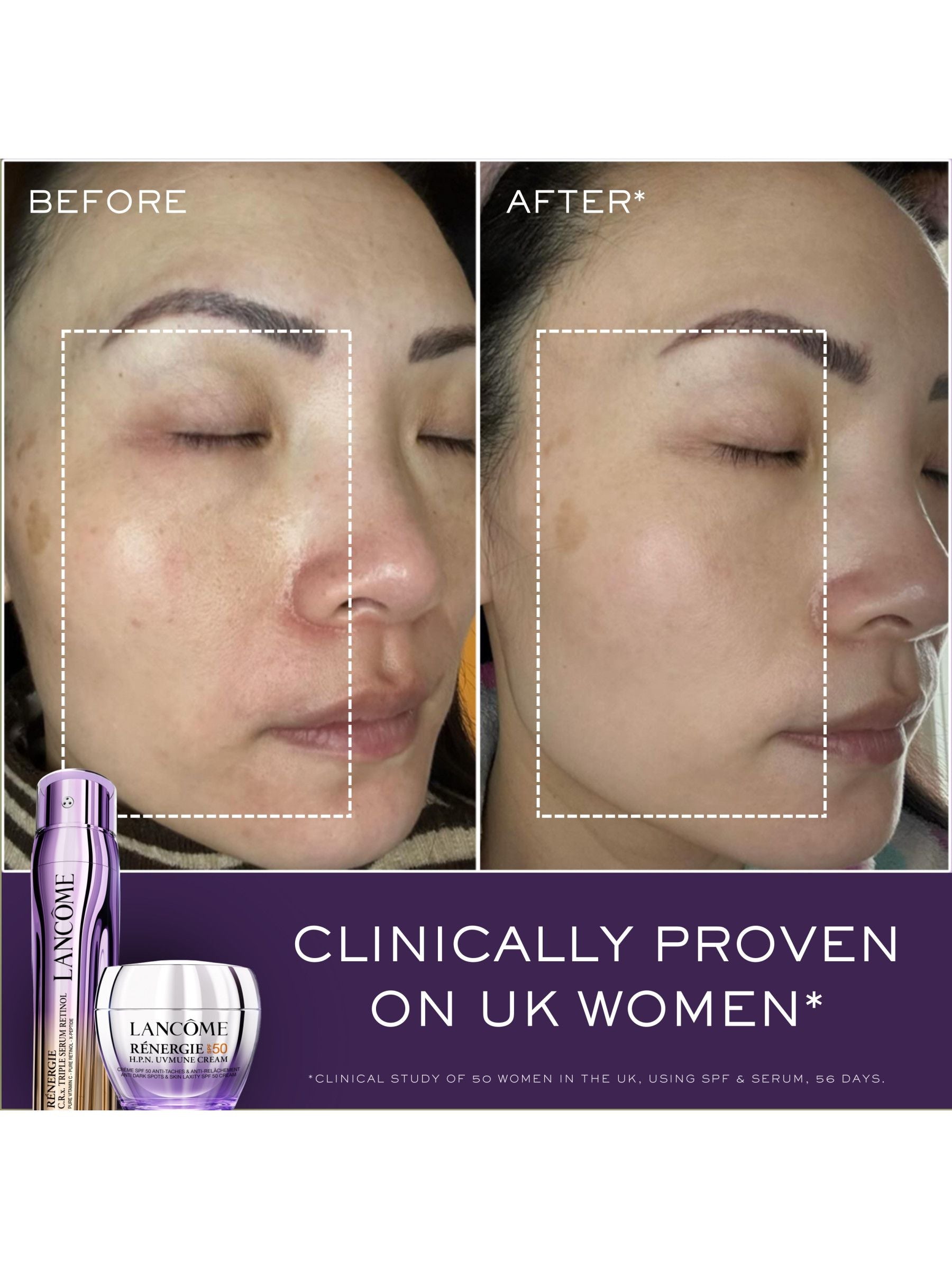 Lancôme Renergie Triple Serum Retinol Set, UK version