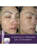 Lancôme Renergie Triple Serum Retinol Set, UK version