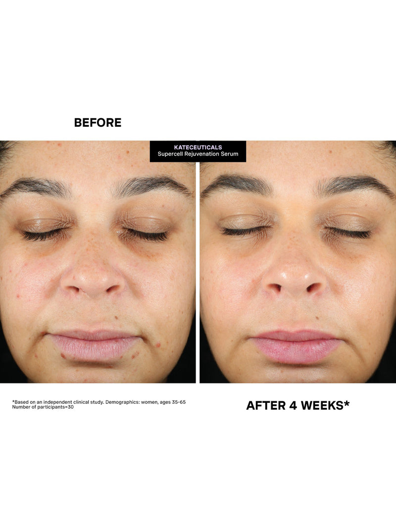 Kate Somerville SuperCell Rejuvenation serum 30ml - British product