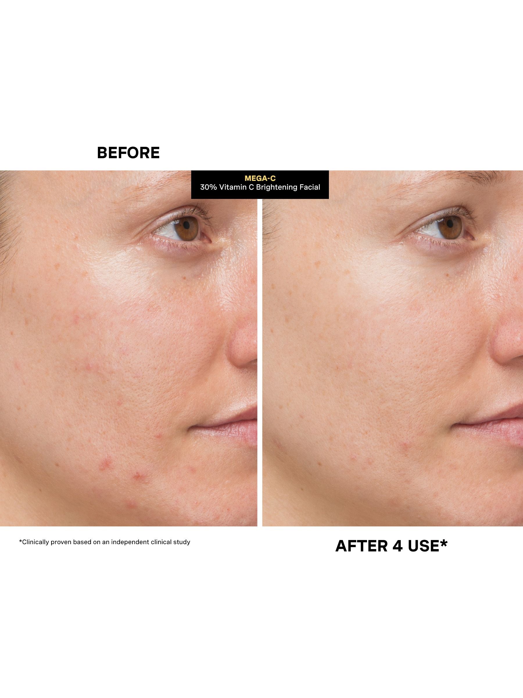 Kate Somerville MegaC Vitamin C Brightening Facial 60ml, imported from the UK