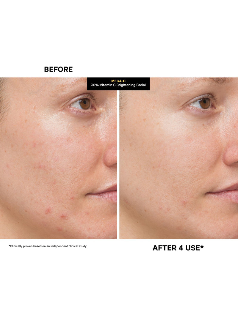 Kate Somerville MegaC Vitamin C Brightening Facial 60ml, imported from the UK