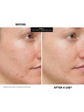 Kate Somerville MegaC Vitamin C Brightening Facial 60ml, imported from the UK