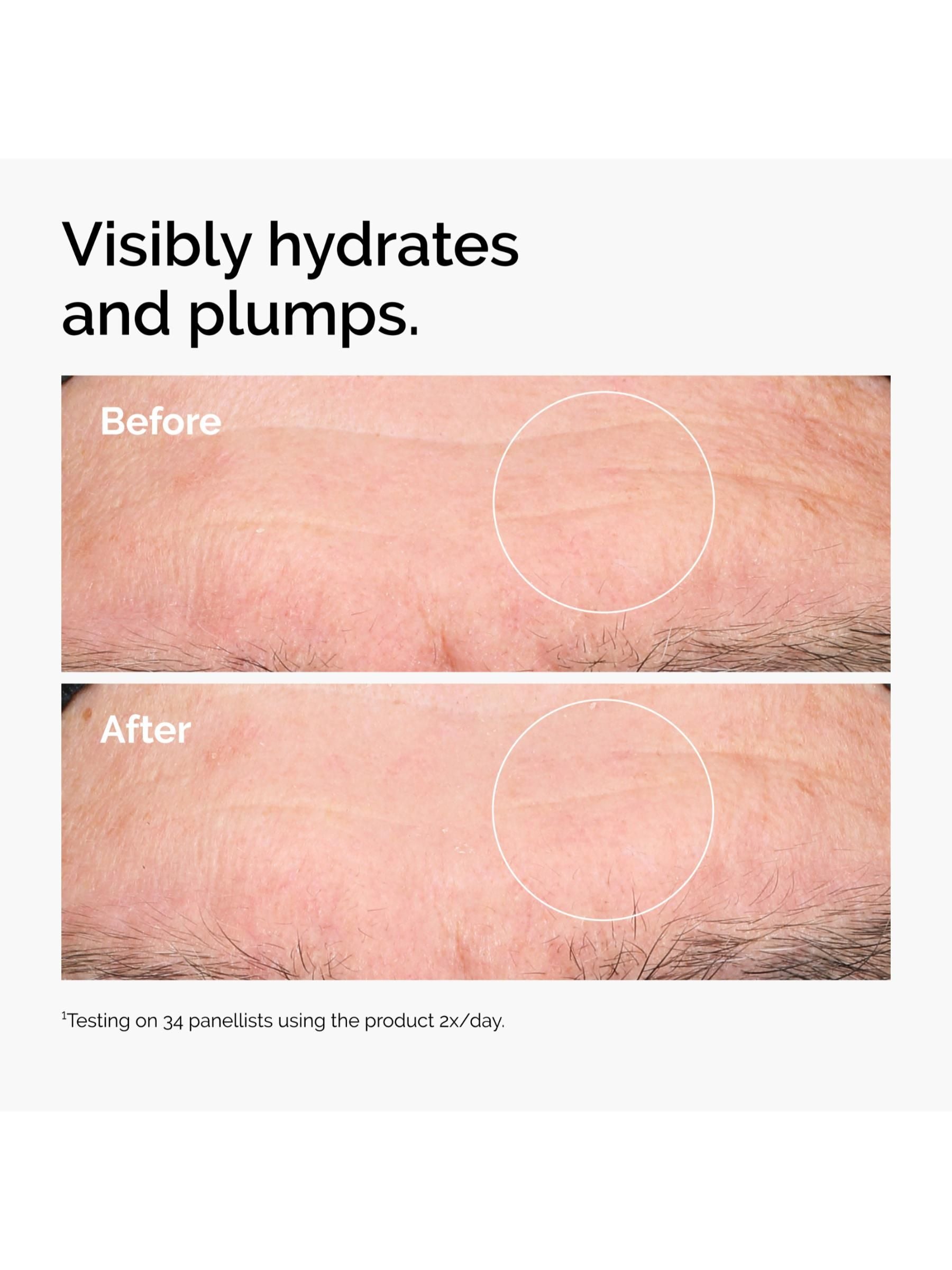 The Ordinary sensitive skin collection, imported from the UK