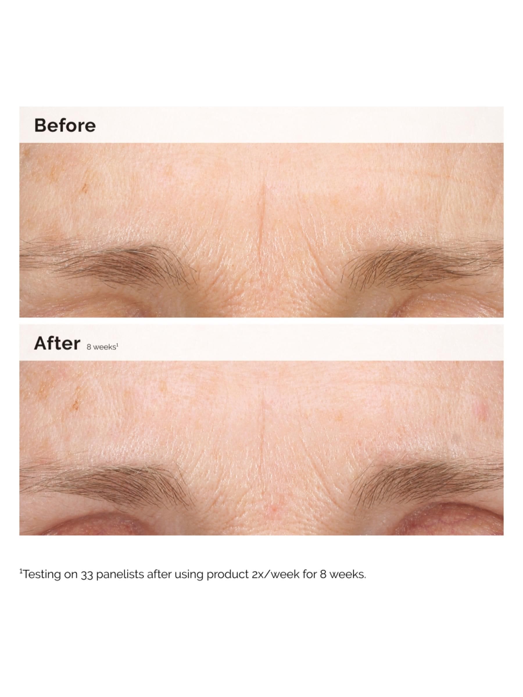 The Ordinary Hydrating Resurfacing Serum and Retinal Night Duo, UK version