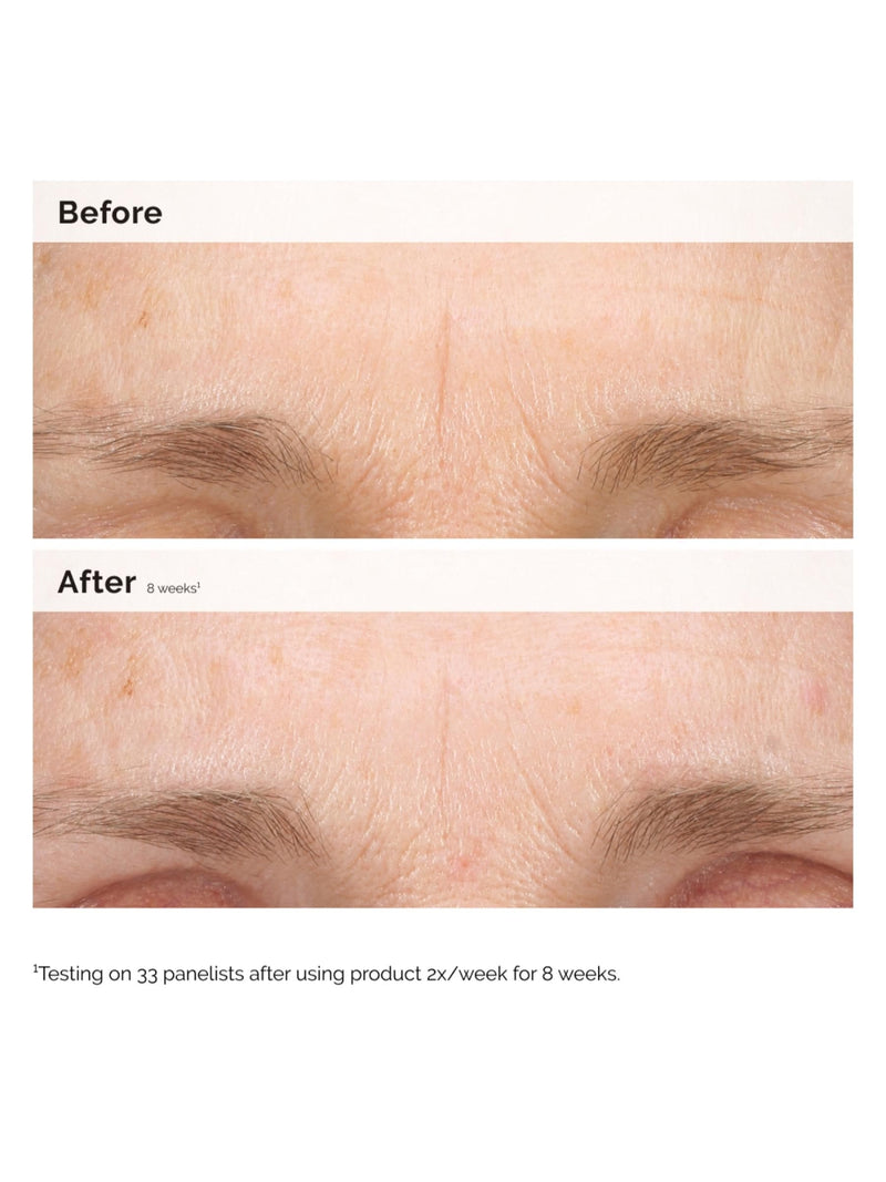 The Ordinary Hydrating Resurfacing Serum and Retinal Night Duo, UK version