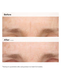The Ordinary Hydrating Resurfacing Serum and Retinal Night Duo, UK version
