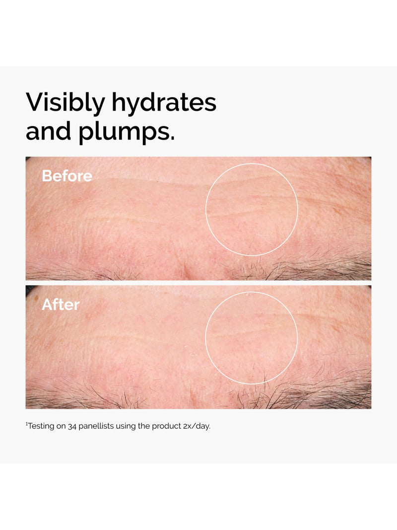 The Ordinary skincare set for radiant skin 30ml and 100ml (British brand)