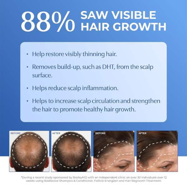 BosleyMD thickening treatment non color-treated hair 100ml, imported from the UK