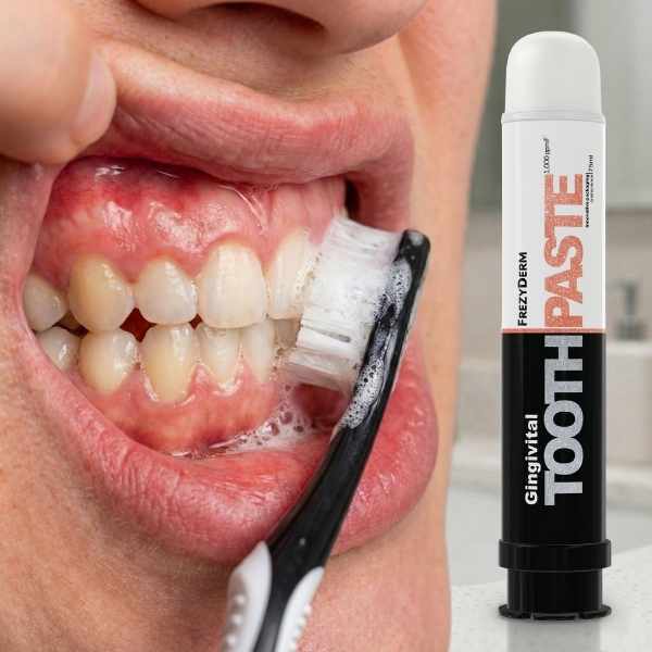 FrezyDerm Gingivital toothpaste 75ml, UK version