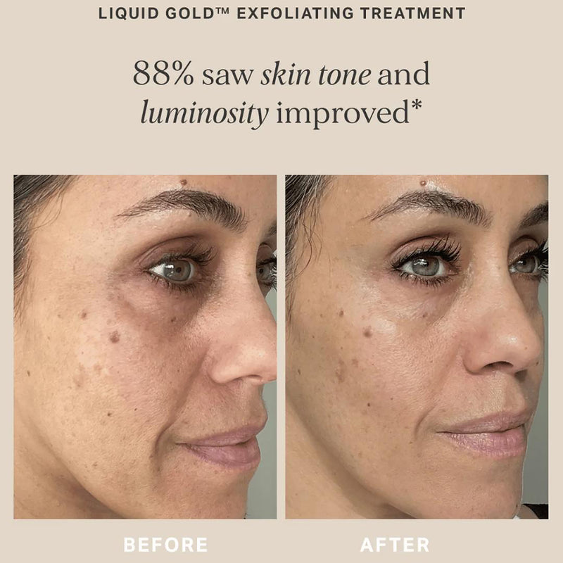 Alpha-H Liquid Gold exfoliating treatment 100ml, UK version