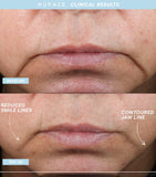 Nuface Trinity+ Starter Kit facial toning device with attachments and serums, imported from the UK