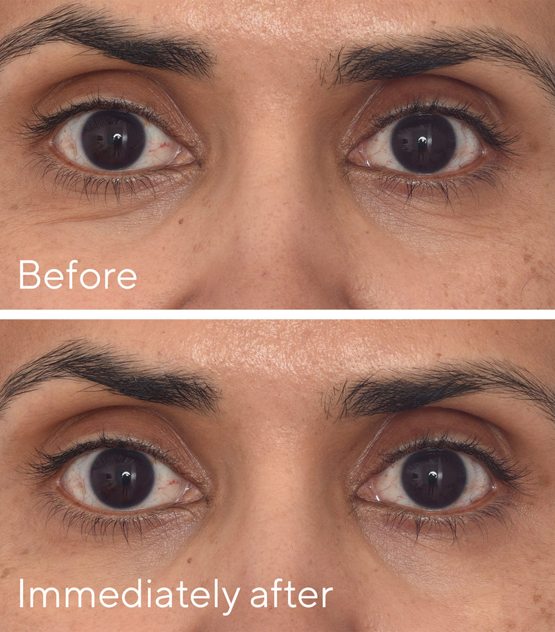 Murad Retinol Youth Renewal Eye Mask Pack of 5, imported from the UK