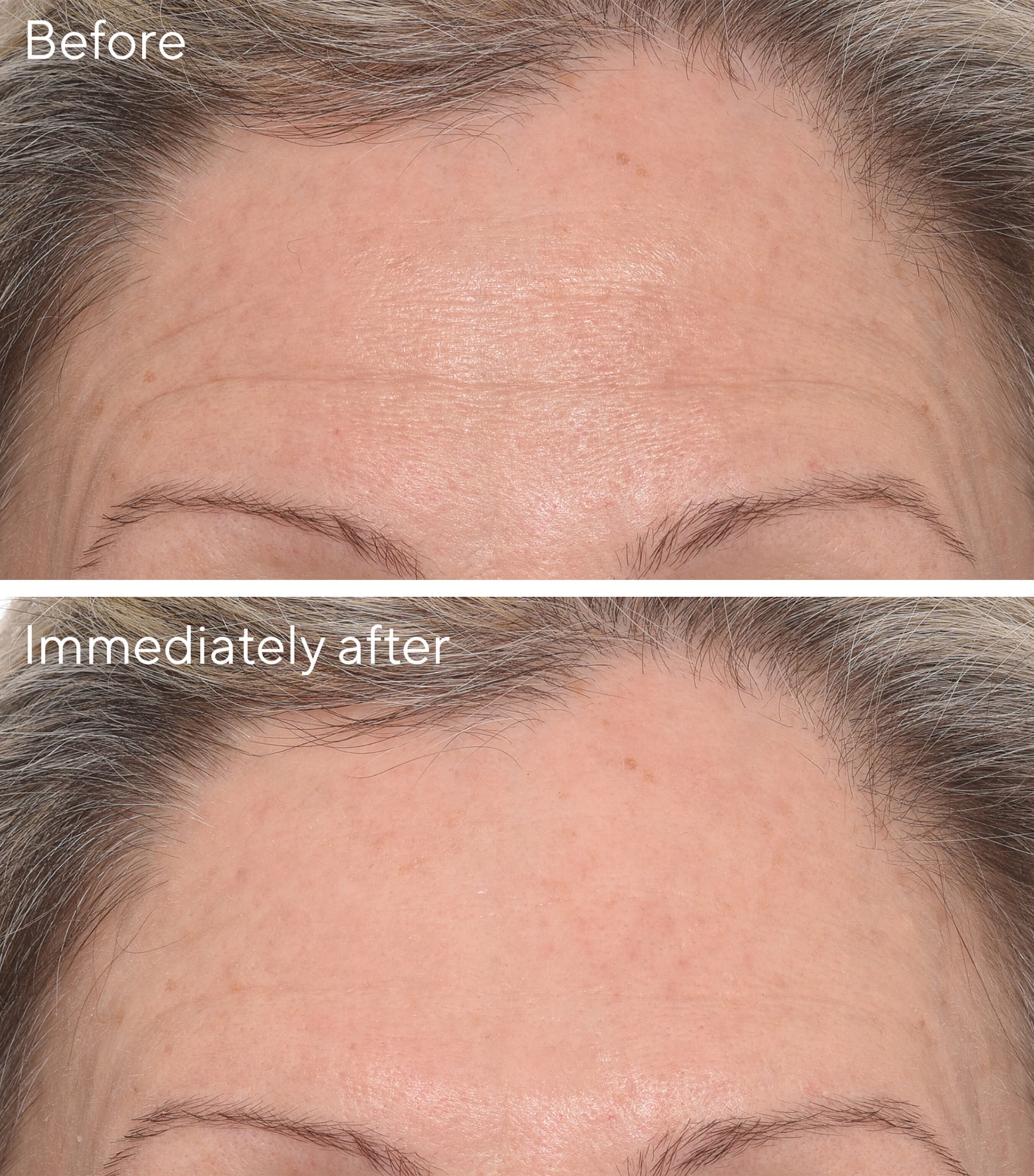 Murad Targeted Wrinkle Corrector 15ml, imported from the UK